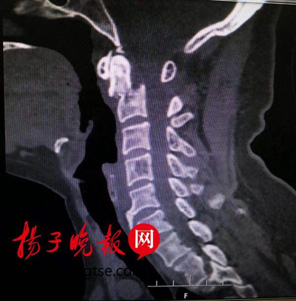 安庆太湖车祸最新新闻，事故现场救援与后续处理